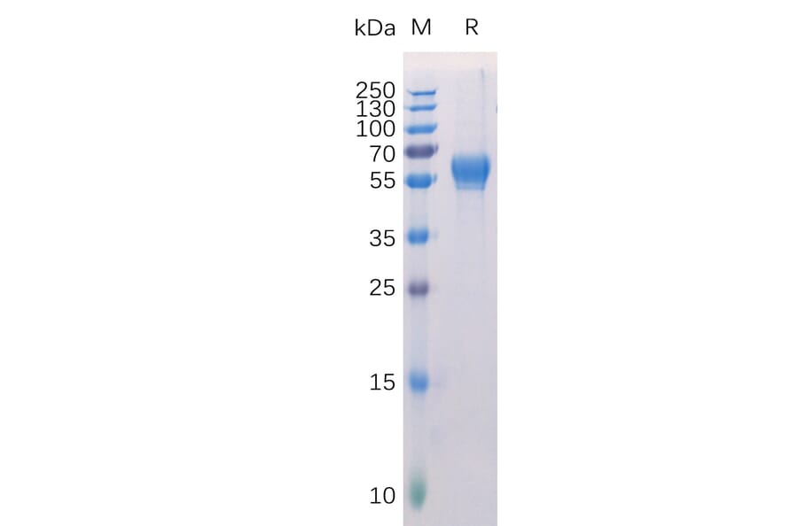 SDS-PAGE - Recombinant Human ROR1 Protein (6×His Tag) (A318271) - Antibodies.com