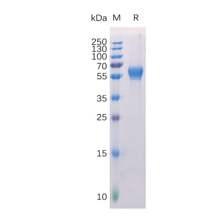 SDS-PAGE - Recombinant Human ROR1 Protein (6×His Tag) (A318271) - Antibodies.com