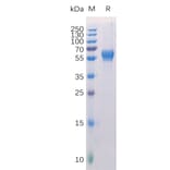 SDS-PAGE - Recombinant Human ROR1 Protein (6×His Tag) (A318271) - Antibodies.com