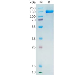 SDS-PAGE - Recombinant Human PSMA Protein (Fc Tag) (A318272) - Antibodies.com
