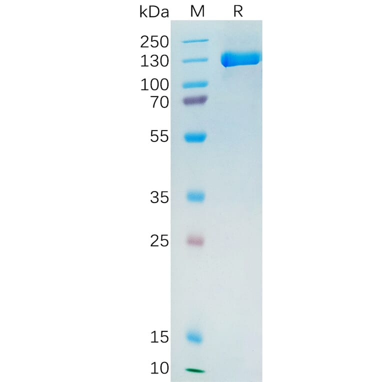 SDS-PAGE - Recombinant Human PSMA Protein (Fc Tag) (A318272) - Antibodies.com