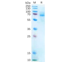 SDS-PAGE - Recombinant Human P2X7 Protein (Fc Tag) (A318273) - Antibodies.com