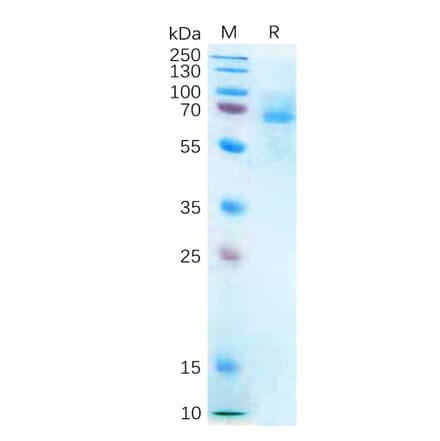 SDS-PAGE - Recombinant Human P2X7 Protein (Fc Tag) (A318273) - Antibodies.com