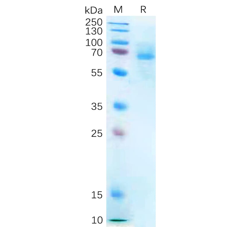 SDS-PAGE - Recombinant Human P2X7 Protein (Fc Tag) (A318273) - Antibodies.com