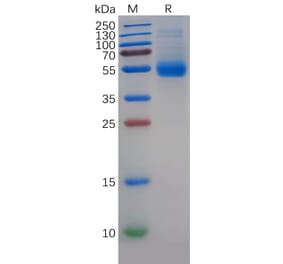 SDS-PAGE - Recombinant Human MIF Protein (Fc Tag) (A318274) - Antibodies.com