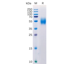 SDS-PAGE - Recombinant Human MICA Protein (6×His Tag) (A318275) - Antibodies.com