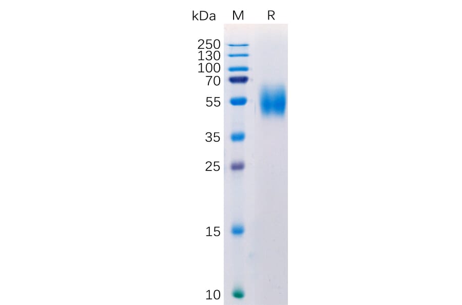 SDS-PAGE - Recombinant Human MICA Protein (6×His Tag) (A318275) - Antibodies.com