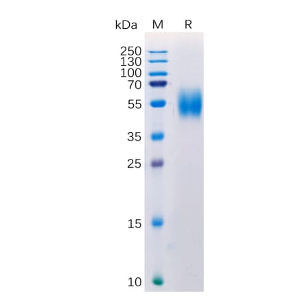 SDS-PAGE - Recombinant Human MICA Protein (6×His Tag) (A318275) - Antibodies.com