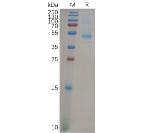 SDS-PAGE - Recombinant Human KRAS Protein (Fc Tag) (A318276) - Antibodies.com
