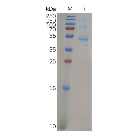 SDS-PAGE - Recombinant Human KRAS Protein (Fc Tag) (A318276) - Antibodies.com