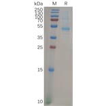 SDS-PAGE - Recombinant Human KRAS Protein (Fc Tag) (A318276) - Antibodies.com