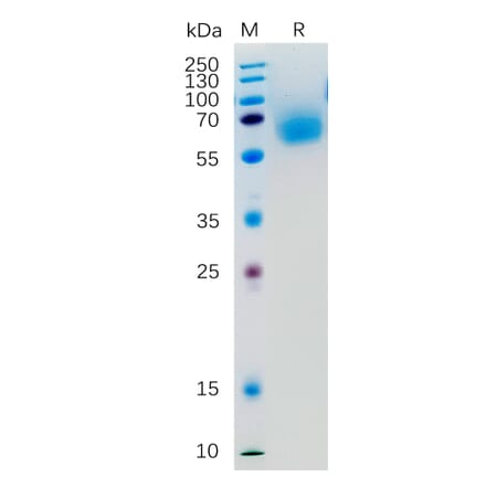 SDS-PAGE - Recombinant Human KLRG1 Protein (Fc Tag) (A318277) - Antibodies.com