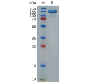 SDS-PAGE - Recombinant Human Integrin beta 1 Protein (Fc Tag) (A318279) - Antibodies.com