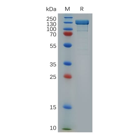 SDS-PAGE - Recombinant Human Integrin beta 1 Protein (Fc Tag) (A318279) - Antibodies.com