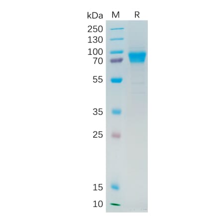 SDS-PAGE - Recombinant Human IL-21R Protein (Fc Tag) (A318280) - Antibodies.com