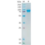 SDS-PAGE - Recombinant Human IL-21R Protein (Fc Tag) (A318280) - Antibodies.com