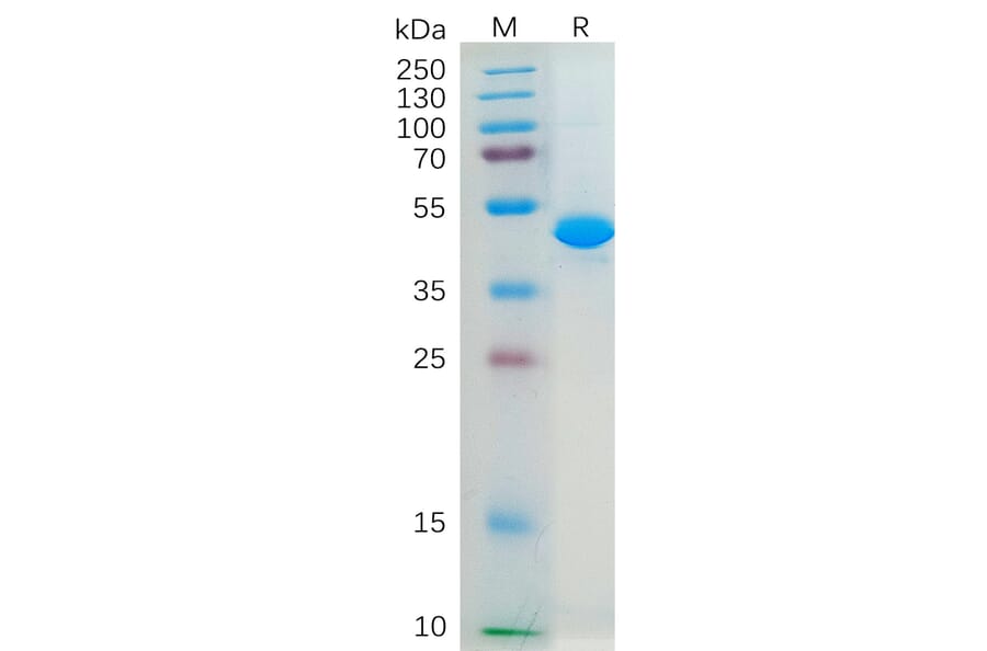 SDS-PAGE - Recombinant Human IL-2 Protein (Fc Tag) (A318281) - Antibodies.com