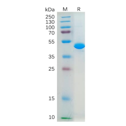 SDS-PAGE - Recombinant Human IL-2 Protein (Fc Tag) (A318281) - Antibodies.com