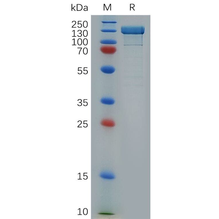 SDS-PAGE - Recombinant Human IL-17RB Protein (6×His Tag) (A318282) - Antibodies.com