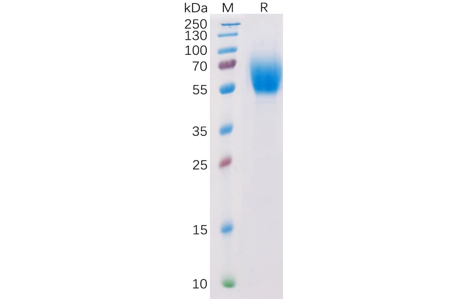 SDS-PAGE - Recombinant Human IL-13 Receptor alpha 1 Protein (6×His Tag) (A318283) - Antibodies.com