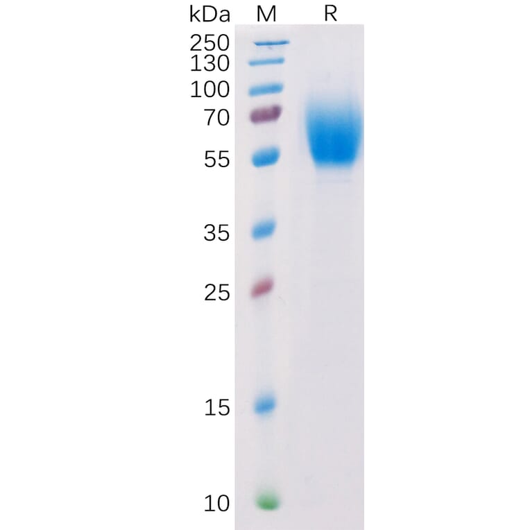SDS-PAGE - Recombinant Human IL-13 Receptor alpha 1 Protein (6×His Tag) (A318283) - Antibodies.com
