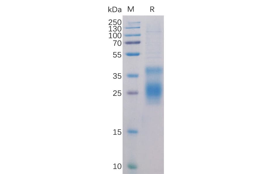 SDS-PAGE - Recombinant Human TNFRSF14/HVEM Protein (6×His Tag) (A318284) - Antibodies.com