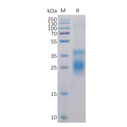 SDS-PAGE - Recombinant Human TNFRSF14/HVEM Protein (6×His Tag) (A318284) - Antibodies.com