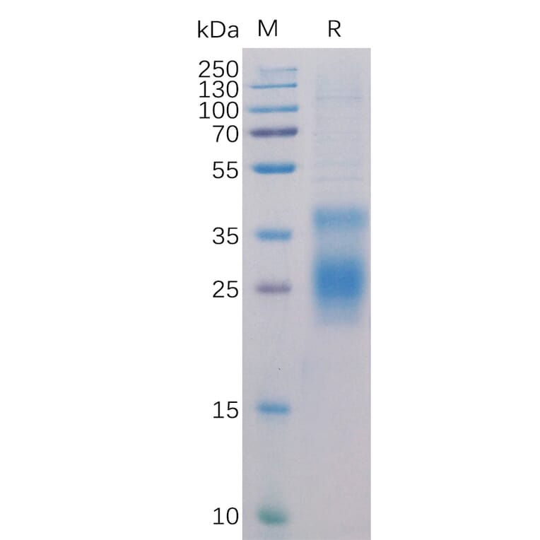 SDS-PAGE - Recombinant Human TNFRSF14/HVEM Protein (6×His Tag) (A318284) - Antibodies.com