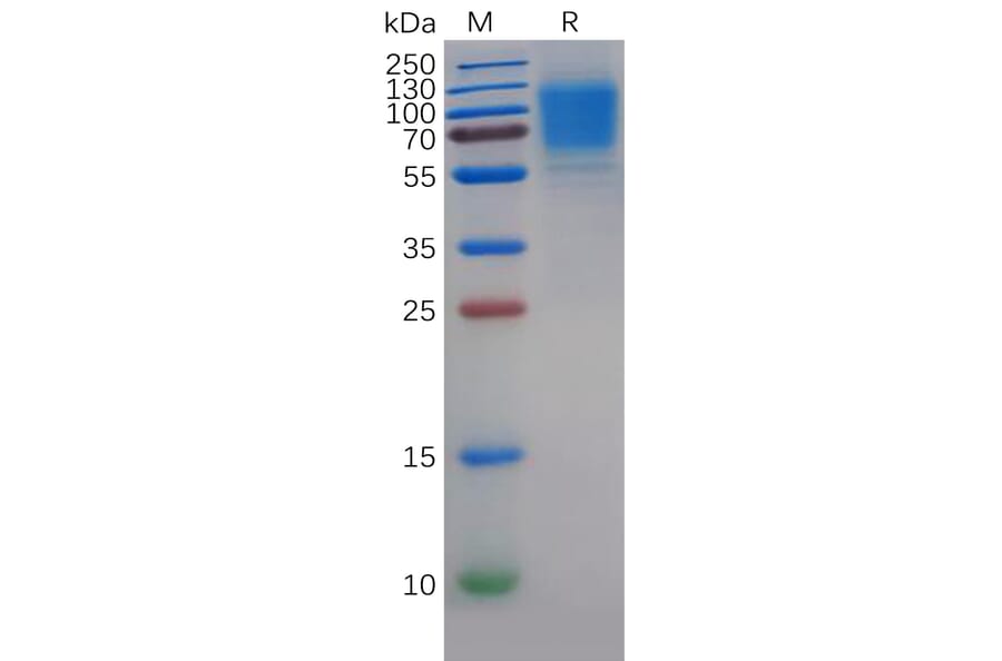 SDS-PAGE - Recombinant Human GC-C Protein (6×His Tag) (A318285) - Antibodies.com