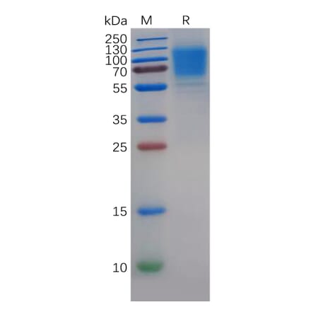 SDS-PAGE - Recombinant Human GC-C Protein (6×His Tag) (A318285) - Antibodies.com