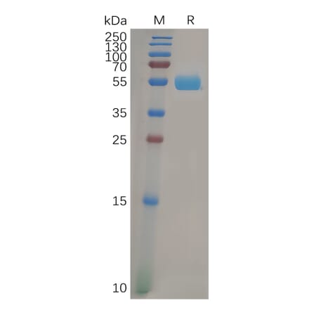 SDS-PAGE - Recombinant Human FOLR2 Protein (Fc Tag) (A318286) - Antibodies.com