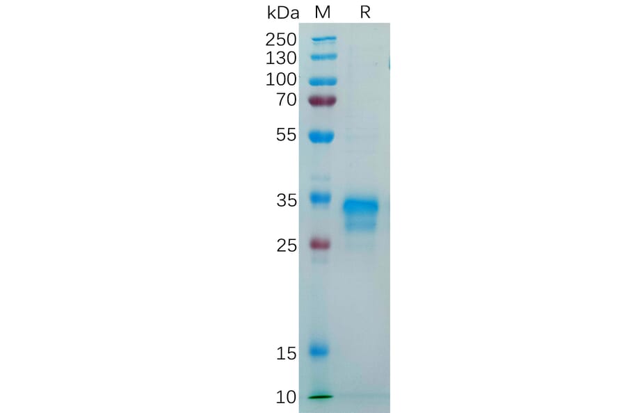 SDS-PAGE - Recombinant Human Folate Binding Protein/FBP Protein (6×His Tag) (A318287) - Antibodies.com