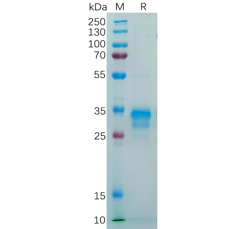 SDS-PAGE - Recombinant Human Folate Binding Protein/FBP Protein (6×His Tag) (A318287) - Antibodies.com