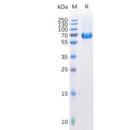SDS-PAGE - Recombinant Human Eph Receptor A2 Protein (6×His Tag) (A318288) - Antibodies.com