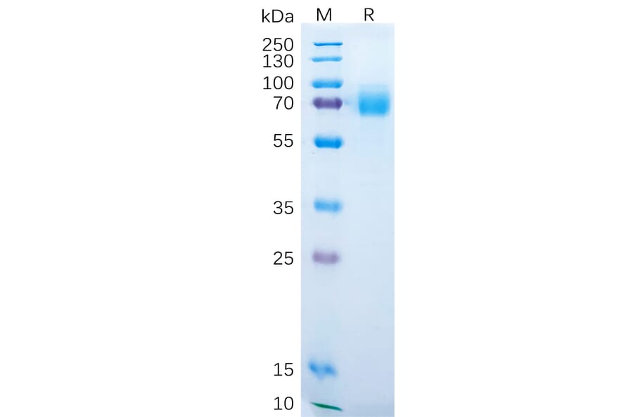 SDS-PAGE - Recombinant Human DKK1 Protein (Fc Tag) (A318289) - Antibodies.com