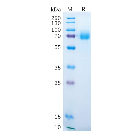 SDS-PAGE - Recombinant Human DKK1 Protein (Fc Tag) (A318289) - Antibodies.com