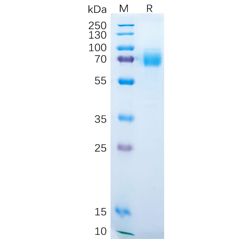 SDS-PAGE - Recombinant Human DKK1 Protein (Fc Tag) (A318289) - Antibodies.com