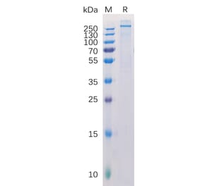SDS-PAGE - Recombinant Human NG2 Protein (6×His Tag) (A318291) - Antibodies.com