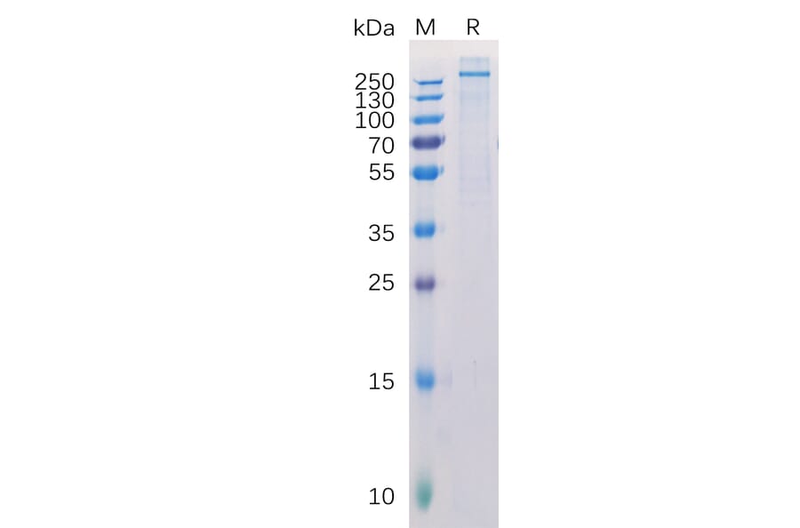 SDS-PAGE - Recombinant Human NG2 Protein (6×His Tag) (A318291) - Antibodies.com