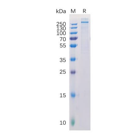 SDS-PAGE - Recombinant Human NG2 Protein (6×His Tag) (A318291) - Antibodies.com