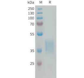 SDS-PAGE - Recombinant Human CRLF2 Protein (6×His Tag) (A318292) - Antibodies.com