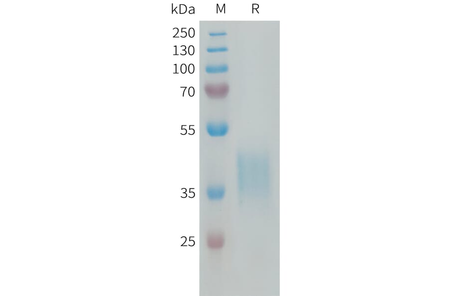 SDS-PAGE - Recombinant Human CRLF2 Protein (6×His Tag) (A318292) - Antibodies.com