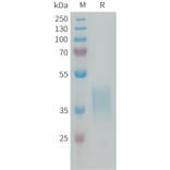 SDS-PAGE - Recombinant Human CRLF2 Protein (6×His Tag) (A318292) - Antibodies.com