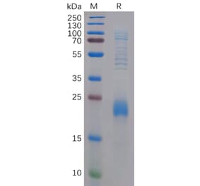 SDS-PAGE - Recombinant Human CLEC2D Protein (6×His Tag) (A318293) - Antibodies.com