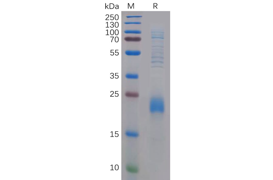 SDS-PAGE - Recombinant Human CLEC2D Protein (6×His Tag) (A318293) - Antibodies.com