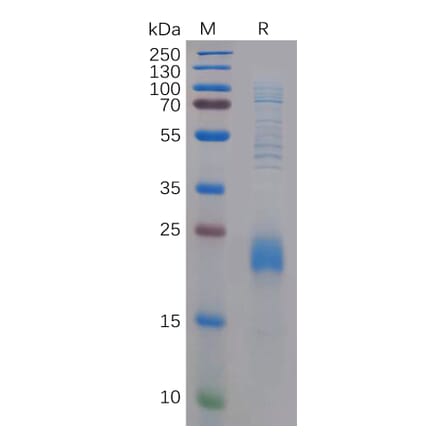 SDS-PAGE - Recombinant Human CLEC2D Protein (6×His Tag) (A318293) - Antibodies.com