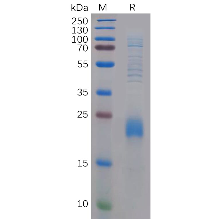 SDS-PAGE - Recombinant Human CLEC2D Protein (6×His Tag) (A318293) - Antibodies.com