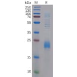 SDS-PAGE - Recombinant Human CLEC2D Protein (6×His Tag) (A318293) - Antibodies.com