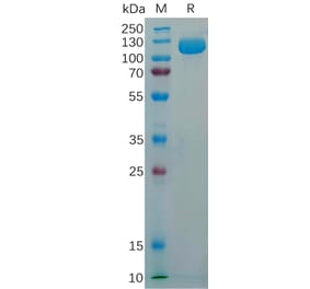 SDS-PAGE - Recombinant Human NCAM1 Protein (6×His Tag) (A318294) - Antibodies.com