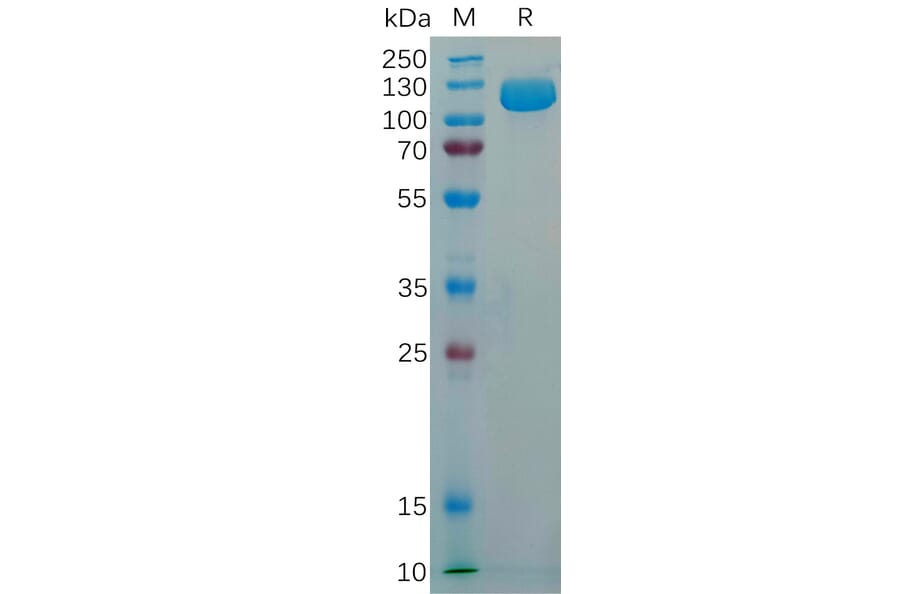 SDS-PAGE - Recombinant Human NCAM1 Protein (6×His Tag) (A318294) - Antibodies.com